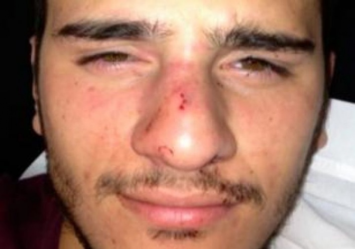 foto: Brutal golpiza a un joven por ser homosexual