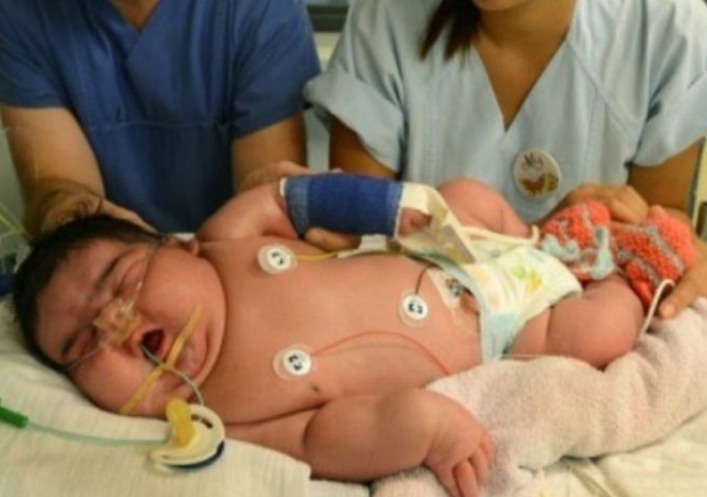 foto: Nació en Alemania el bebé más grande del mundo