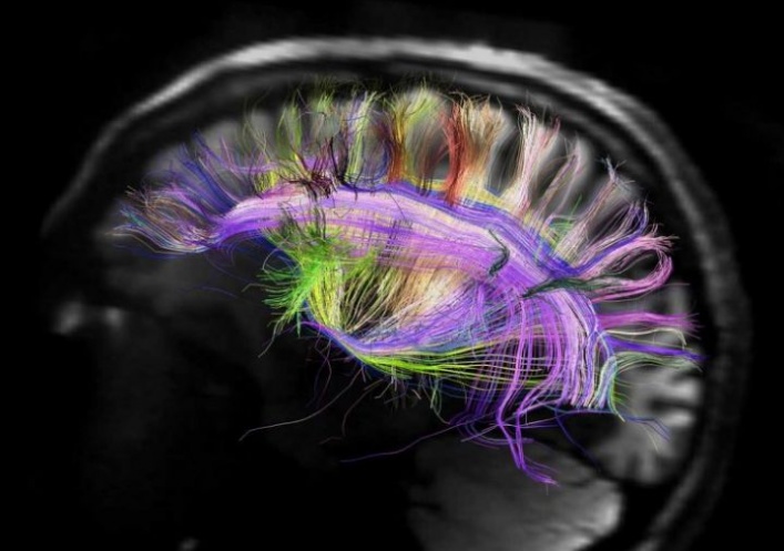 foto: Científicos logran eliminar malos recuerdos del cerebro