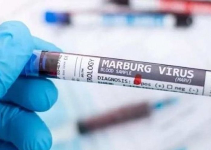 foto: Virus de Marburgo: la OMS aumenta la vigilancia sanitaria