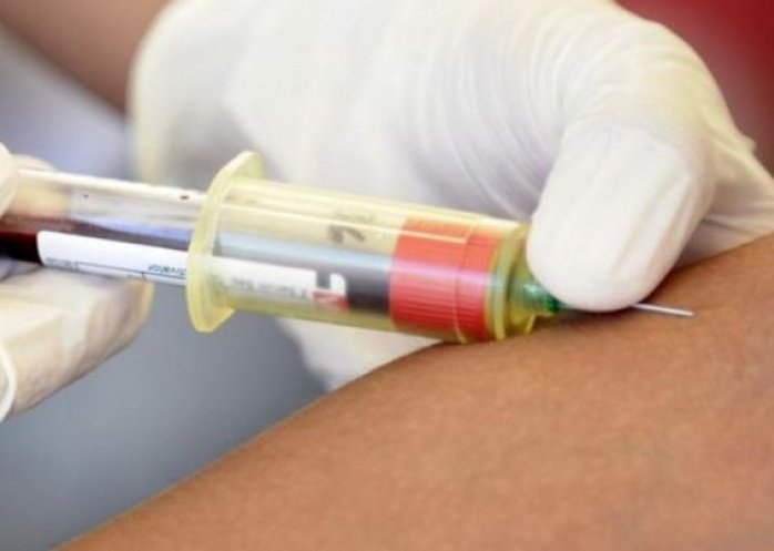 foto: Un tercer enfermo de VIH logra curarse tras un trasplante de células madre
